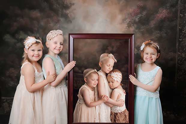 childhood cancer
